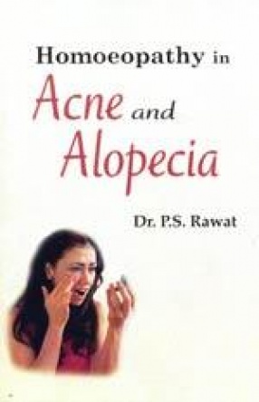 Homoeopathy in Acne & Alopecia