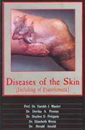 The Diseases of Skin: Including of Exanthemata