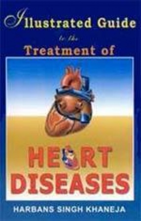 Illustrated Guide to the Treatment of Heart Diseases