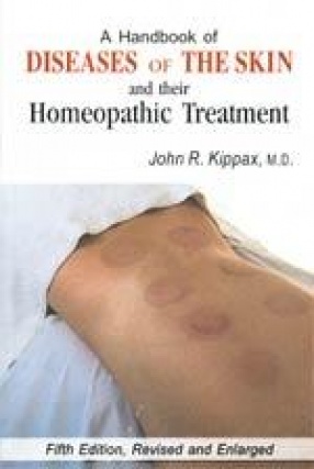 A Handbook of Diseases of Skin and their Homeopathic Treatment