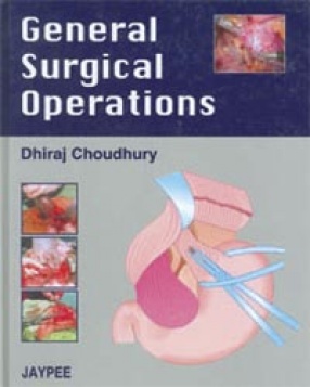 General Surgical Operations 