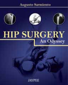 Hip Surgery 