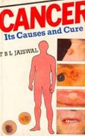 Cancer: Its Causes and Cure