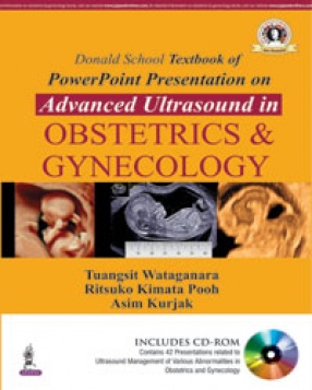 Donald School Textbook of PowerPoint Presentation on Advanced Ultrasound in Obstetrics & Gynecology