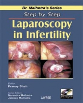 Dr Malhotra Series: Step by Step Laparoscopy in Infertility