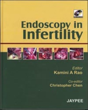 Endoscopy in Infertility