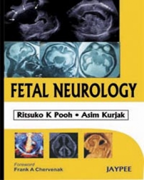 Fetal Neurology