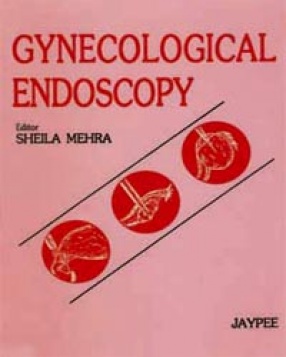 Gynaecology Endoscopy