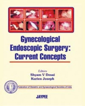 Gynecological Endoscopic Surgery: Current Concepts