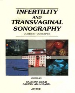 Infertility and Transvaginal Sonography: Current Concepts