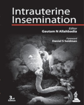 Intrauterine Insemination 