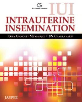 IUI Intrauterine Insemination 