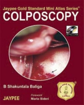 Jaypee Gold Standard Mini Atlas Series Colposcopy