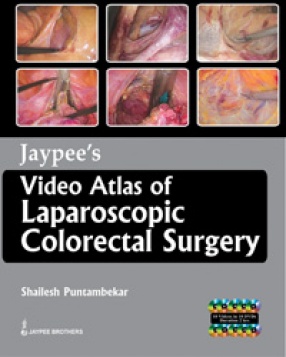 Jaypee's Video Atlas of Laparoscopic Colorectal Surgery 