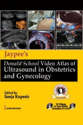 Jaypee’s Donald School Video Atlas Of Ultrasound in Obstetrics and Gynecology