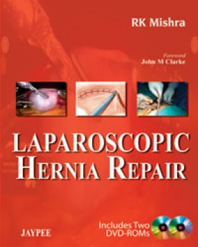 Laparoscopic Hernia Repair