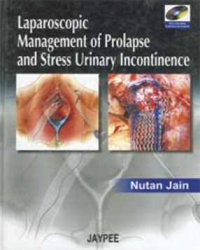 Laparoscopic Management of Prolapse and Stress Urinary Incontinence