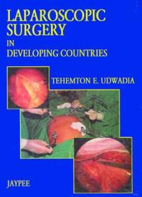 Laparoscopic Surgery in Developing Countries