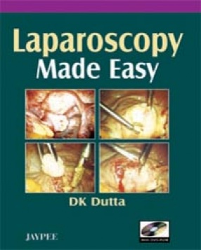 Laparoscopy Made Easy
