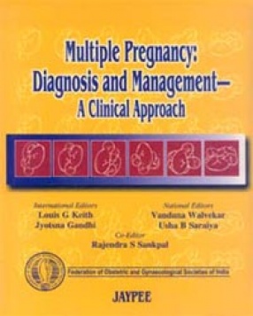 Multiple Pregnancy: Diagnosis and Management- A Clinical Approach