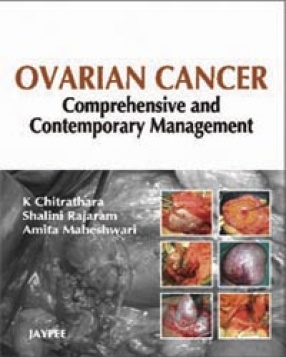 Ovarian Cancer: Comprehensive and Contemporary Management