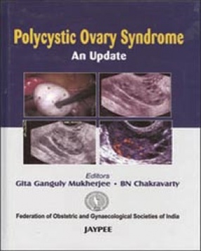 Polycystic Ovary Syndrome: An Update