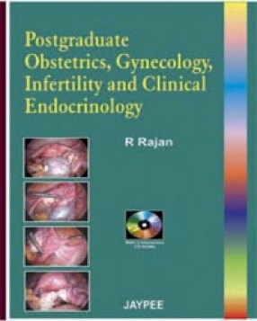 Postgraduate Obstetrics, Gynecology Infertility and Clinical Endocrinology 