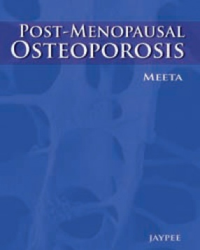 Postmenopausal Osteoporosis: Basic and Clinical Concepts 