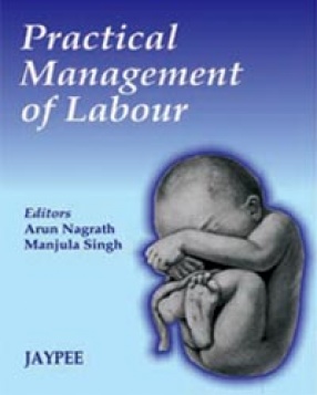 Practical Management of Labour 