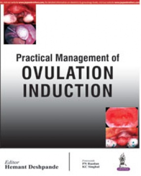 Practical Management of Ovulation Induction 