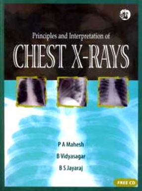 Principles and Interpretation of Chest X-Rays (With CD-Rom)