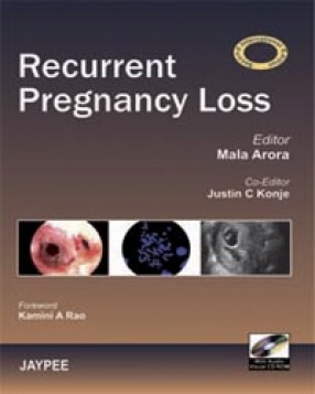 Recurrent Pregnancy Loss