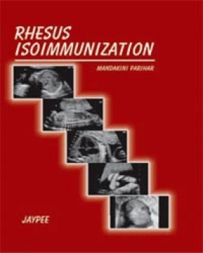 Rhesus Isoimmunization 