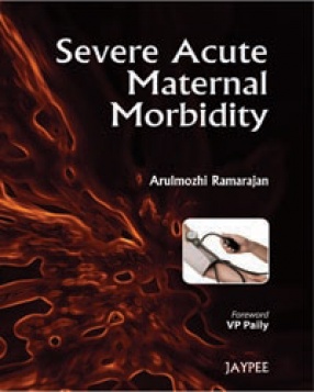 Severe Acute Maternal Morbidity