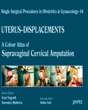 Single Surgical Procedures in Obstetrics and Gynaecology-16: A Colour Atlas of Supravaginal Cervical Amputation