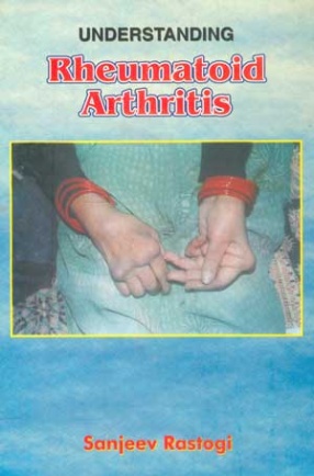 Understanding Rheumatoid Arthritis