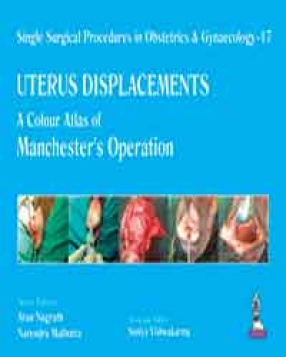 Single Surgical Procedures in Obstetrics and Gynaecology–17: A Colour Atlas of Manchester's Operation