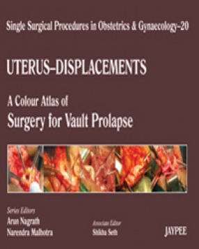 Single Surgical Procedures in Obstetrics and Gynaecology–20: A Colour Atlas of Surgery for Vault Prolapse 