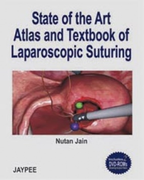 State of The Art Atlas and Textbook of Laparoscopic Suturing 