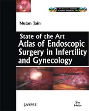 State of the Art: Atlas and Endoscopy Surgery in Infertility and Gynecology