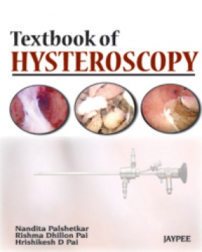 Textbook of Hysteroscopy 
