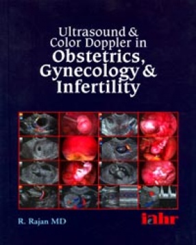 Ultrasound and Color Doppler in Obstetrics, Gynaecology and Infertility