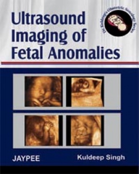 Ultrasound Imaging of Fetal Anomalies