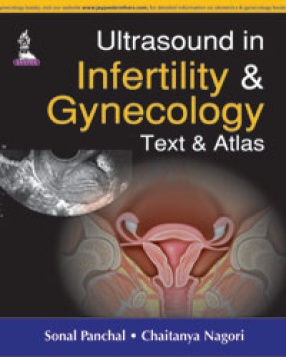 Ultrasound in Infertility and Gynecology: Text and Atlas 