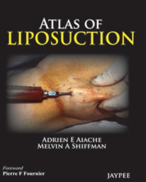 Atlas of Liposuction