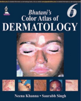 Bhutani’s Color Atlas of Dermatology