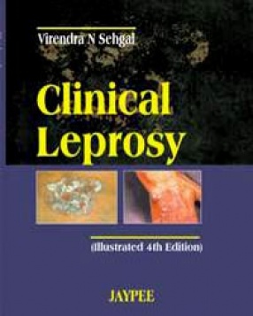 Clinical Leprosy