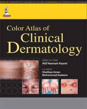 Color Atlas of Clinical Dermatology