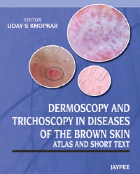 Dermoscopy and Trichoscopy in Diseases of the Brown Skin 
