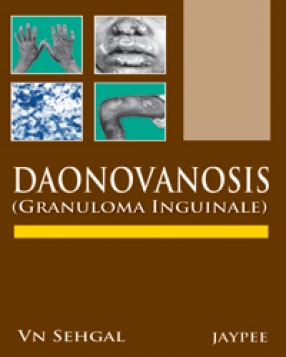 Donovanosis: Granuloma Inguinale